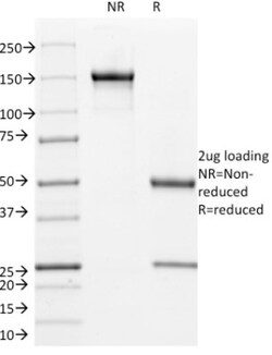 L1CAM Mouse anti-Human, Clone: UJ127, Novus Biologicals:Antibodies:Primary